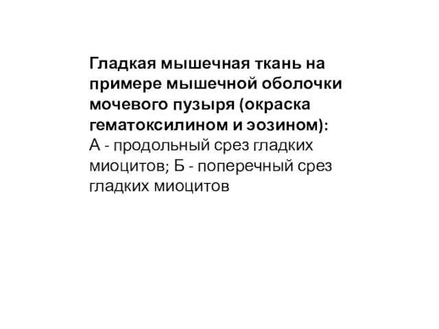 Гладкая мышечная ткань на примере мышечной оболочки мочевого пузыря (окраска гематоксилином