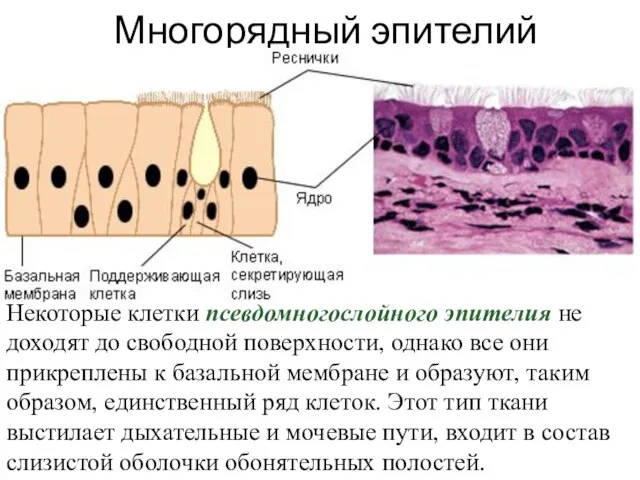 Многорядный эпителий Некоторые клетки псевдомногослойного эпителия не доходят до свободной поверхности,