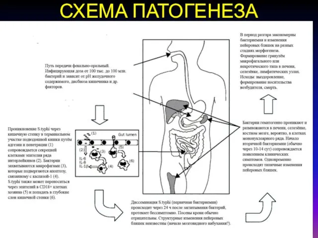 СХЕМА ПАТОГЕНЕЗА