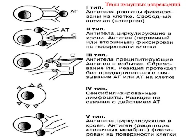 Типы иммунных повреждений.