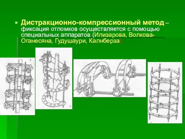 Дистракционно-компрессионный метод – фиксация отломков осуществляется с помощью специальных аппаратов (Илизарова, Волкова-Оганесяна, Гудушаури, Калнберза)