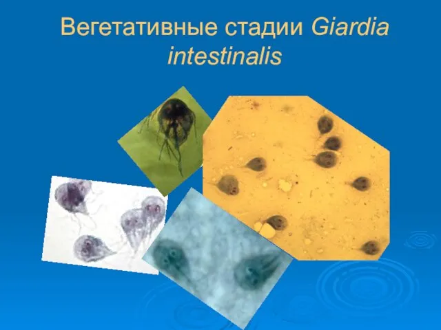 Вегетативные стадии Giardia intestinalis
