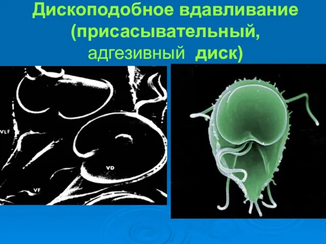 Дископодобное вдавливание (присасывательный, адгезивный диск)