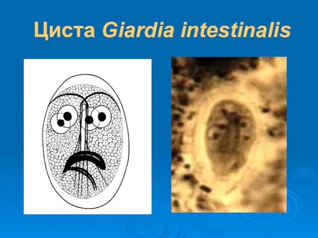 Циста Giardia intestinalis