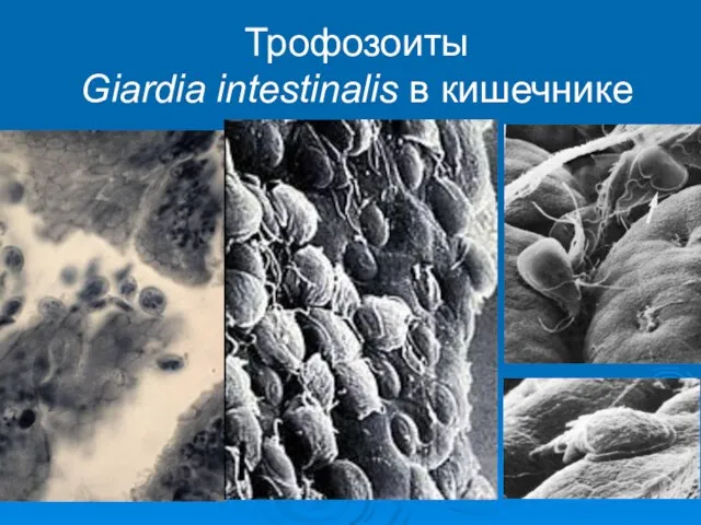 Трофозоиты Giardia intestinalis в кишечнике