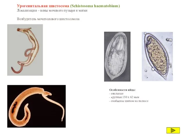 Урогенитальная шистосома (Schistosoma haematobium) Локализация – вены мочевого пузыря и матки