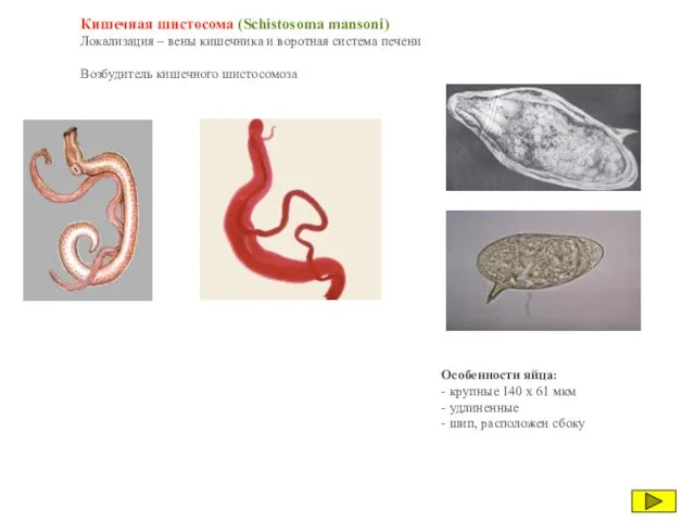 Кишечная шистосома (Schistosoma mansoni) Локализация – вены кишечника и воротная система