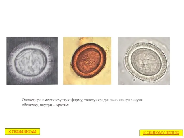 Онкосфера имеет округлую форму, толстую радиально исчерченную оболочку, внутри – крючья К СВИНОМУ ЦЕПНЮ К ГЕЛЬМИНТАМ