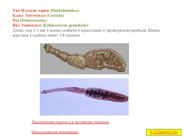 Тип Плоские черви (Plathelminthes) Класс Ленточные (Cestoda) Род (Echinococcus) Вид Эхинококк