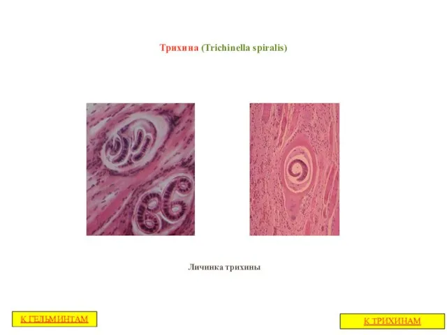 Трихина (Trichinella spiralis) Личинка трихины К ТРИХИНАМ К ГЕЛЬМИНТАМ