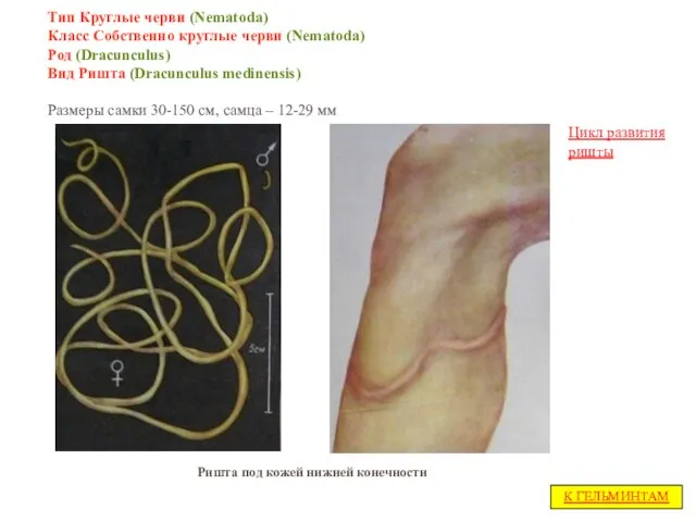 Тип Круглые черви (Nematoda) Класс Собственно круглые черви (Nematoda) Род (Dracunculus)