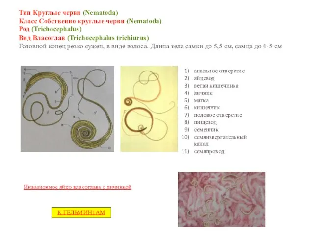 Тип Круглые черви (Nematoda) Класс Собственно круглые черви (Nematoda) Род (Trichocephalus)