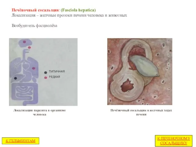 Печёночный сосальщик (Fasciola hepatica) Локализация – желчные протоки печени человека и