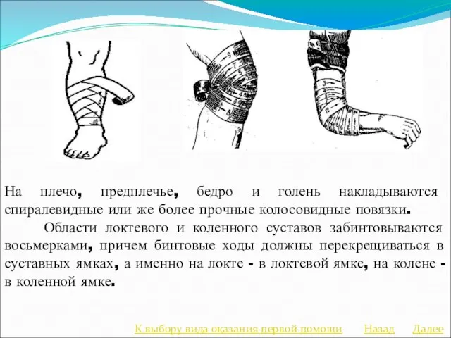 На плечо, предплечье, бедро и голень накладываются спиралевидные или же более