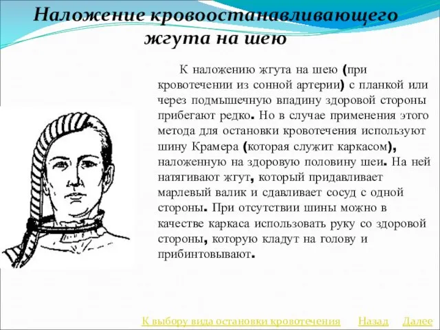 Наложение кровоостанавливающего жгута на шею К наложению жгута на шею (при