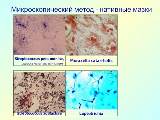 Микроскопический метод - нативные мазки