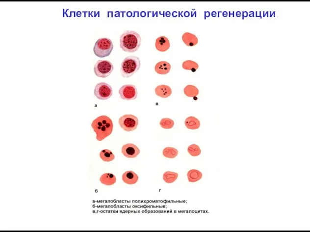 Клетки патологической регенерации