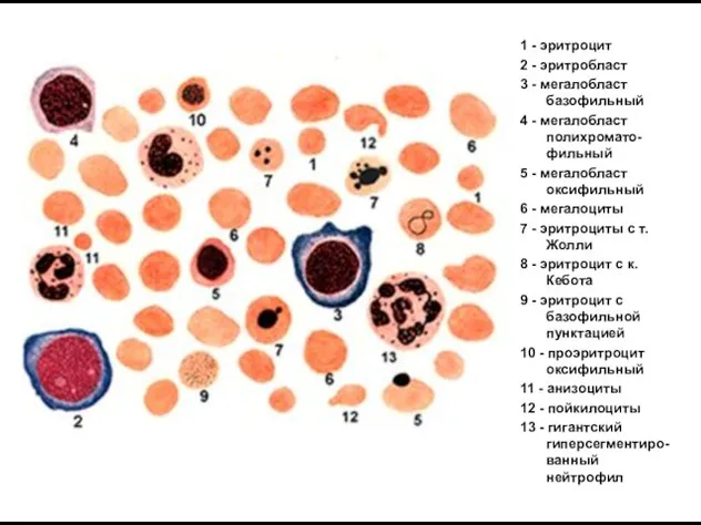 1 - эритроцит 2 - эритробласт 3 - мегалобласт базофильный 4