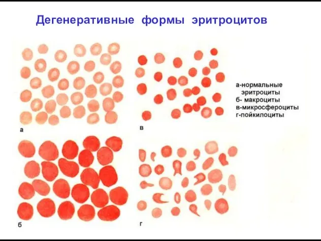 Дегенеративные формы эритроцитов