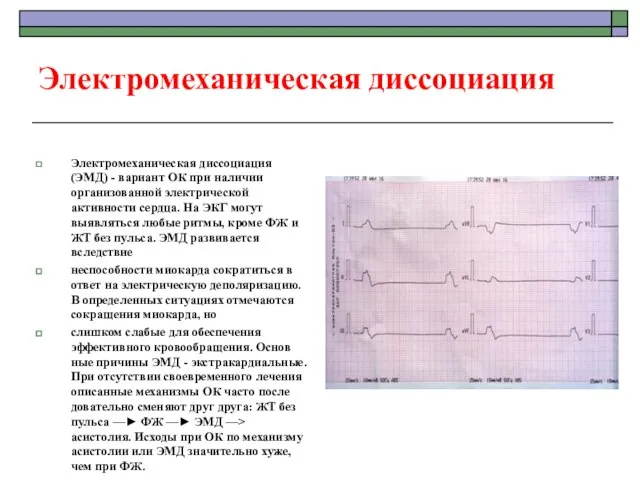 Электромеханическая диссоциация Электромеханическая диссоциация (ЭМД) - вариант ОК при наличии организованной