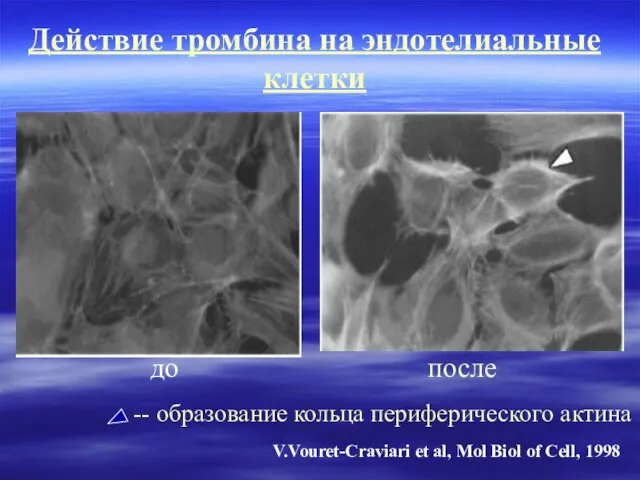 Действие тромбина на эндотелиальные клетки до после -- образование кольца периферического