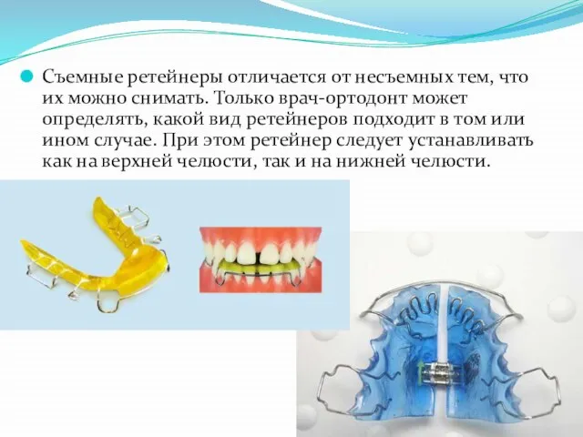 Съемные ретейнеры отличается от несъемных тем, что их можно снимать. Только