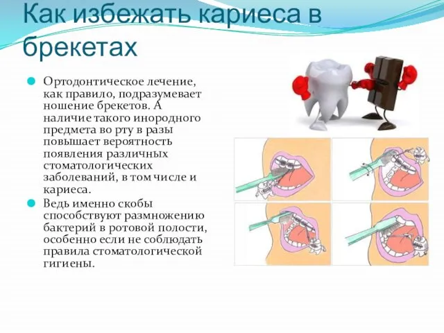 Как избежать кариеса в брекетах Ортодонтическое лечение, как правило, подразумевает ношение