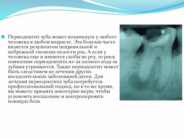 Периодонтит зуба может возникнуть у любого человека в любом возрасте. Эта