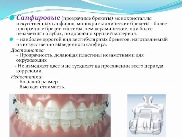 Сапфировые (прозрачные брекеты) монокристаллы искусственных сапфиров, монокристаллические брекеты - более прозрачные