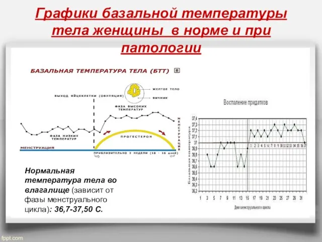 Графики базальной температуры тела женщины в норме и при патологии Нормальная