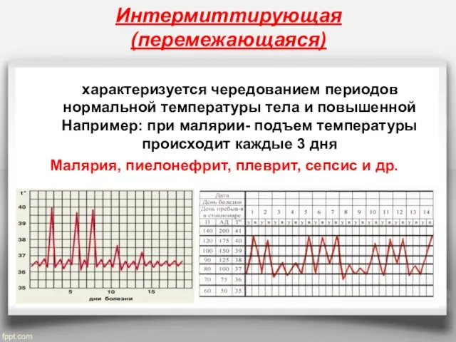 Интермиттирующая (перемежающаяся) характеризуется чередованием периодов нормальной температуры тела и повышенной Например: