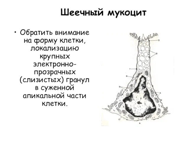 Шеечный мукоцит Обратить внимание на форму клетки, локализацию крупных электронно-прозрачных (слизистых)