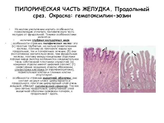 ПИЛОРИЧЕСКАЯ ЧАСТЬ ЖЕЛУДКА. Продольный срез. Окраска: гематоксилин-эозин На малом увеличении изучить