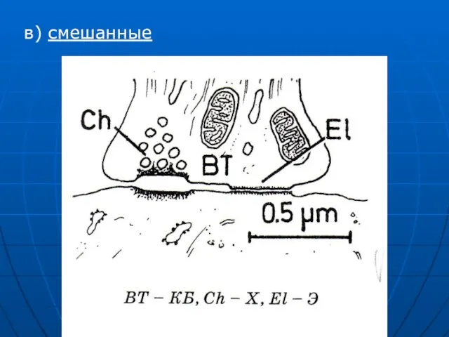 в) смешанные