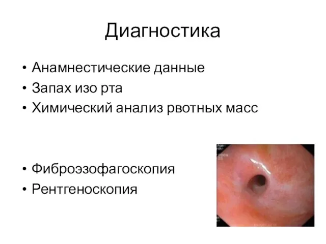 Диагностика Анамнестические данные Запах изо рта Химический анализ рвотных масс Фиброэзофагоскопия Рентгеноскопия