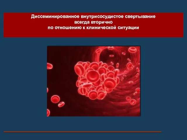 Диссеминированное внутрисосудистое свертывание всегда вторично по отношению к клинической ситуации