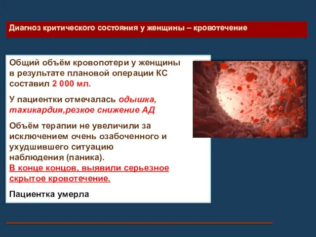 Диагноз критического состояния у женщины – кровотечение Общий объём кровопотери у