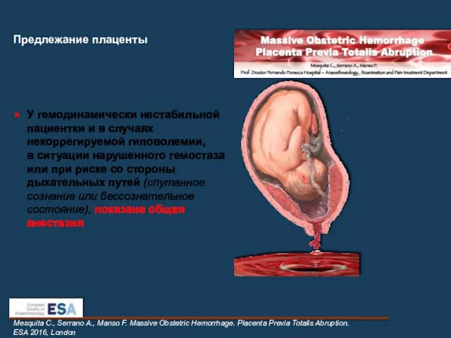 Предлежание плаценты Mesquita C., Serrano A., Manso F. Massive Obstetric Hemorrhage.