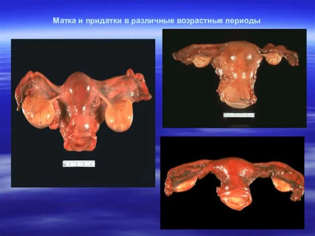 Матка и придатки в различные возрастные периоды