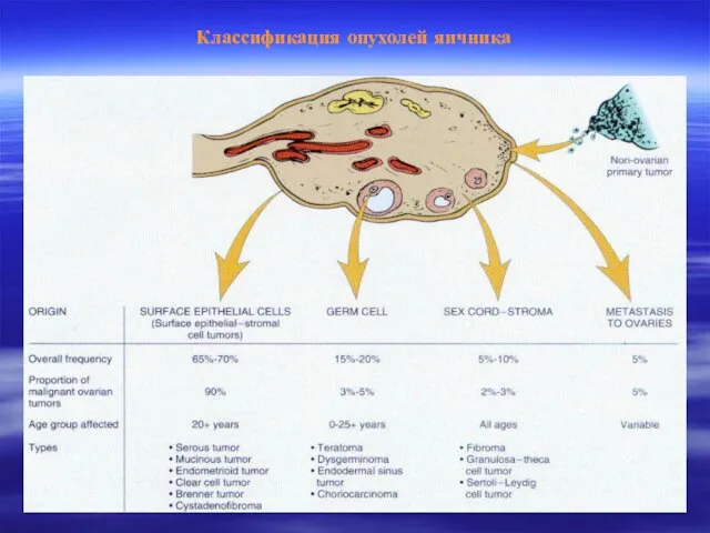 Классификация опухолей яичника