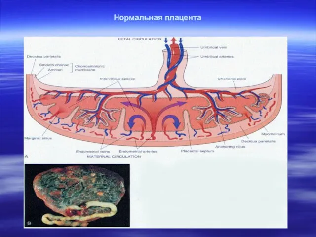 Нормальная плацента