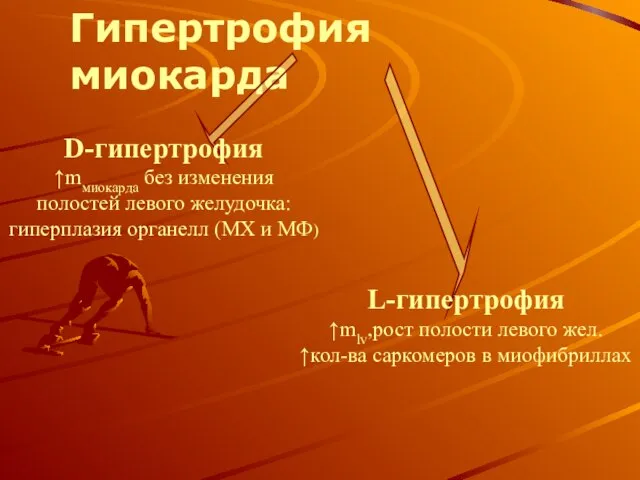 Гипертрофия миокарда