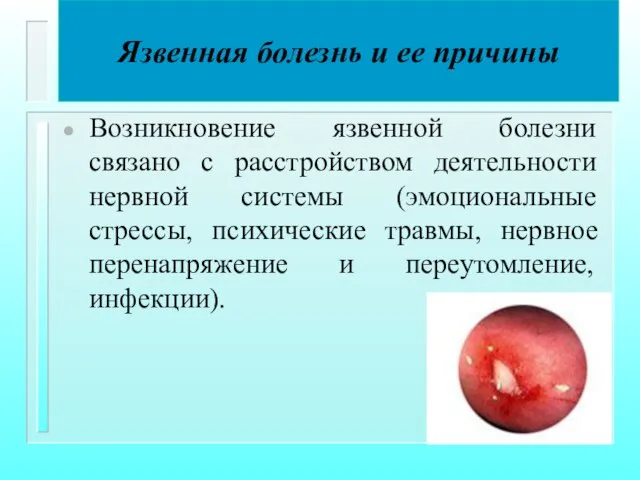 Язвенная болезнь и ее причины Возникновение язвенной болезни связано с расстройством