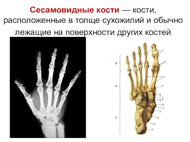 Сесамовидные кости — кости, расположенные в толще сухожилий и обычно лежащие на поверхности других костей