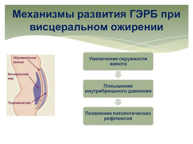 Механизмы развития ГЭРБ при висцеральном ожирении