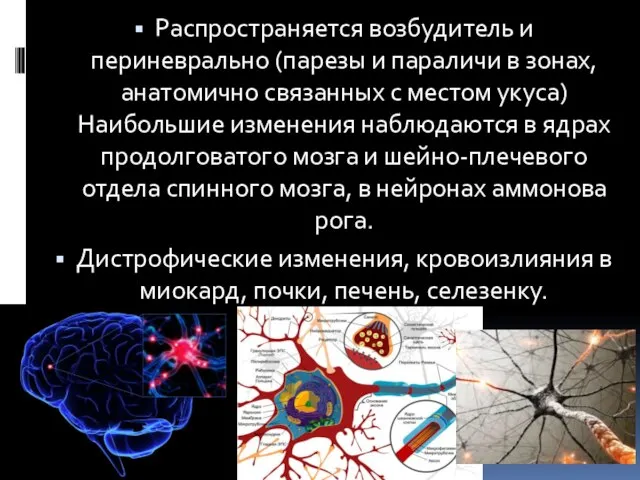 Распространяется возбудитель и периневрально (парезы и параличи в зонах, анатомично связанных