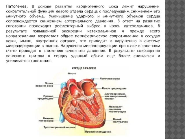 Патогенез. В основе развития кардиогенного шока лежит нарушение сократительной функции левого