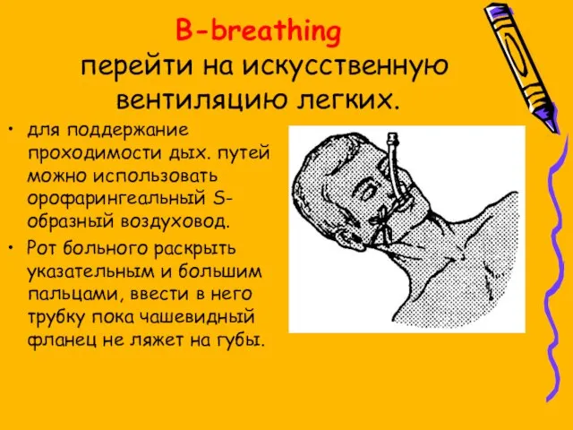 B-breathing перейти на искусственную вентиляцию легких. для поддержание проходимости дых. путей