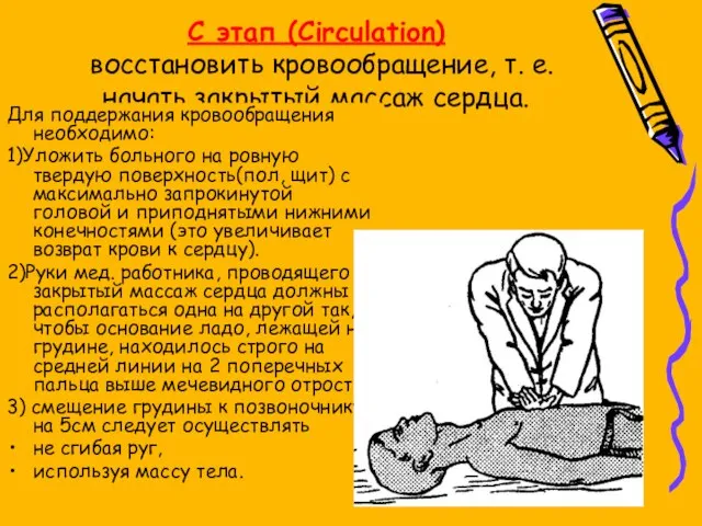 C этап (Circulation) восстановить кровообращение, т. е. начать закрытый массаж сердца.