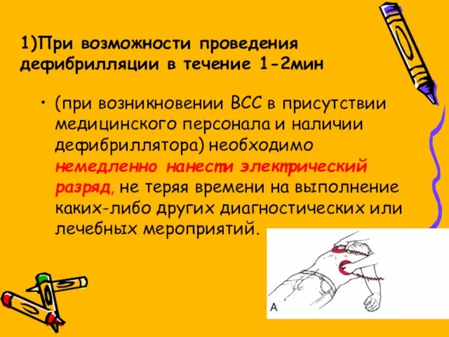 1)При возможности проведения дефибрилляции в течение 1-2мин (при возникновении ВСС в